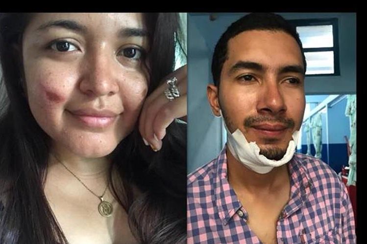 Los esposos Mario Colindres y Marcela Hintz solo resultaron con golpes leves en el accidente del bus, en el kilómetro 214, El Jute, Los Amates, Izabal. (Foto Prensa Libre: Tomada de Facebook) 